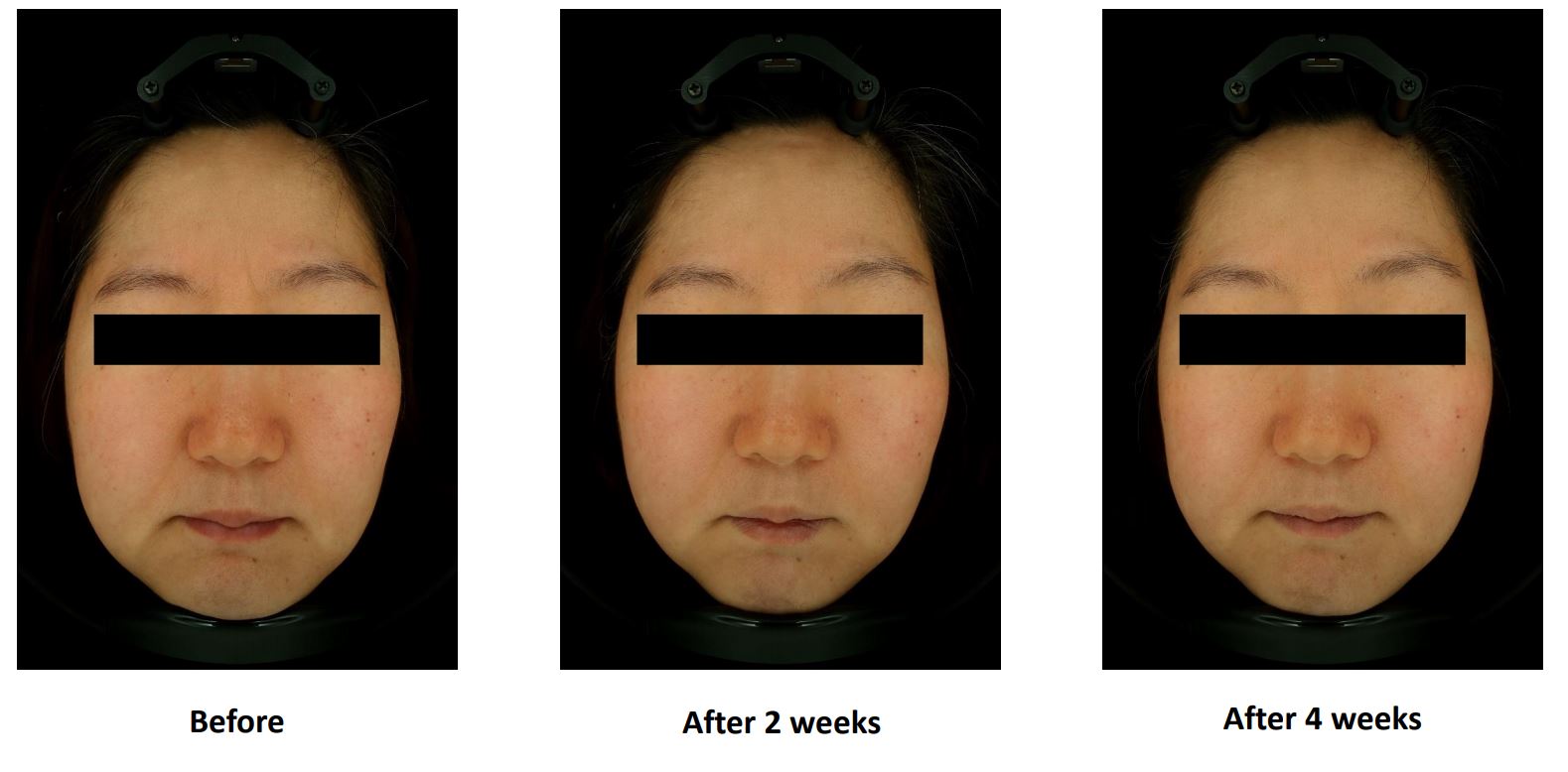 Cell Return Brightening Before & After