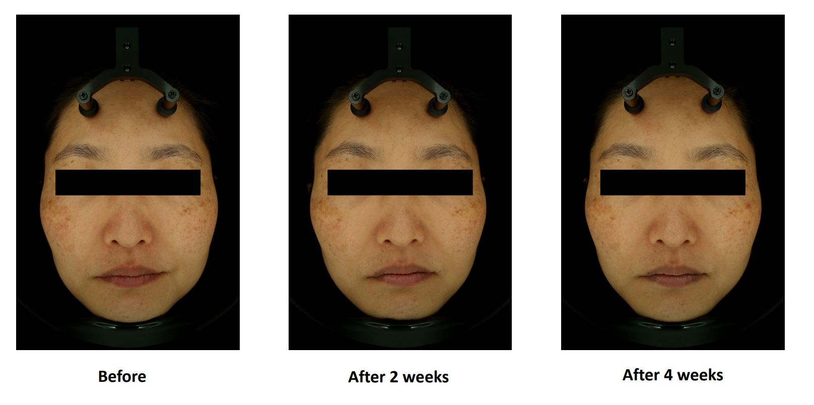 Cell Return Brightening Before & After 2